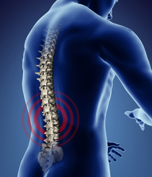 aandoeningen en therapieën op het gebied van houding en het bewegingsapparaat